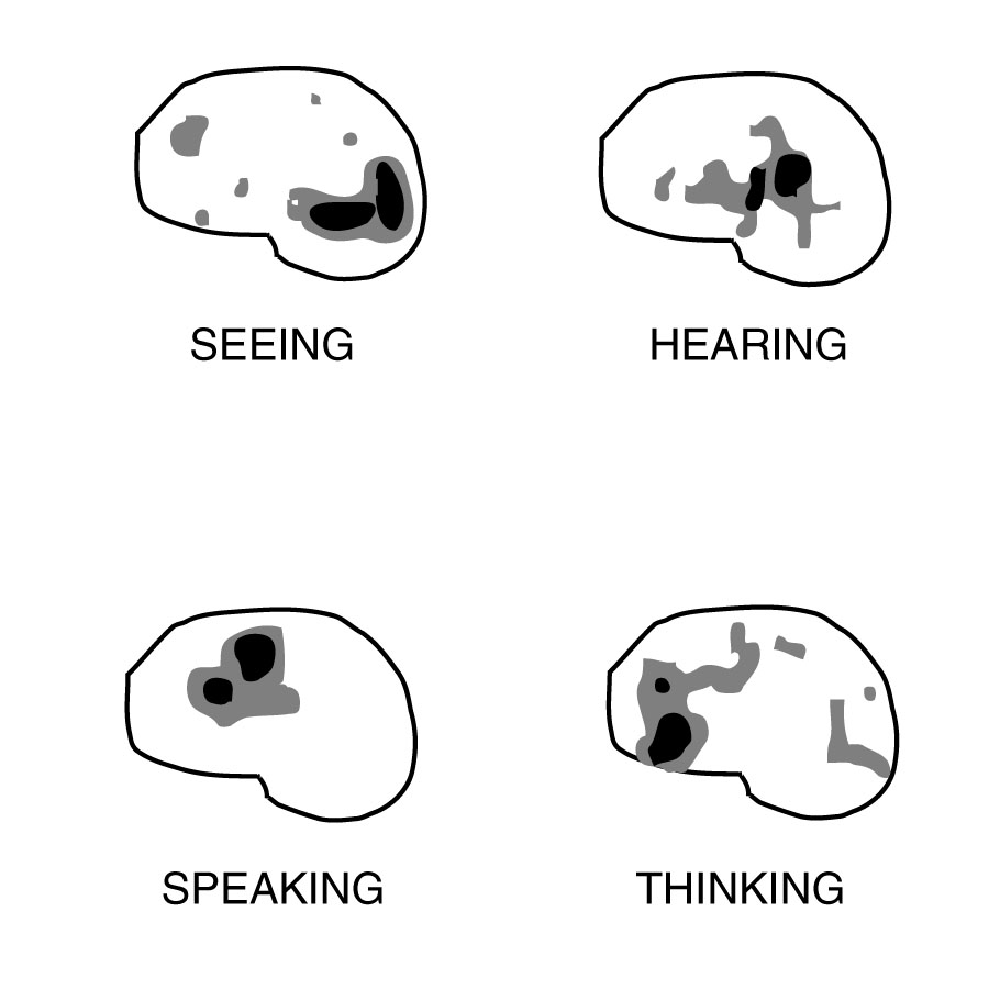 4 pet scans